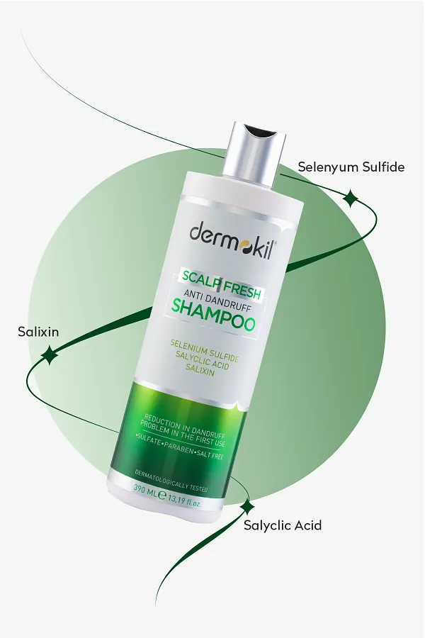 شامبو سكالت فريش لمكافحة القشرة - 190 مل