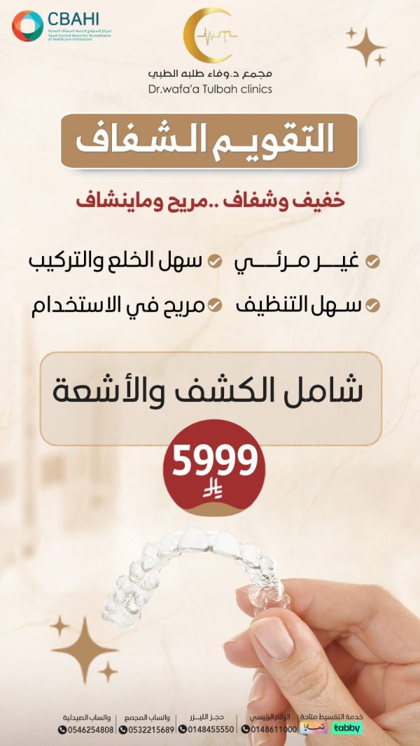 التقويم الشفاف