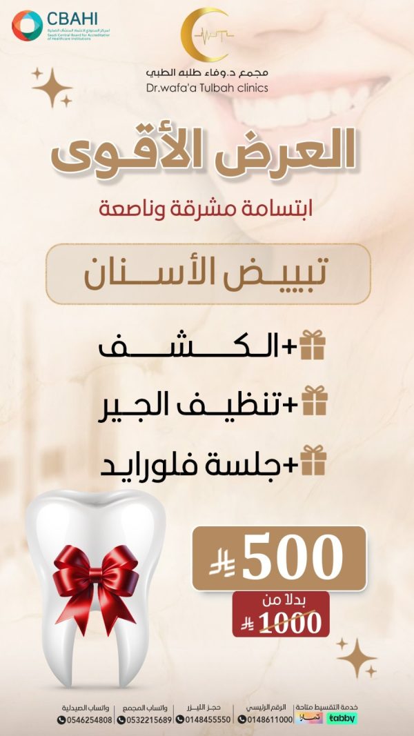 تبييض السنان